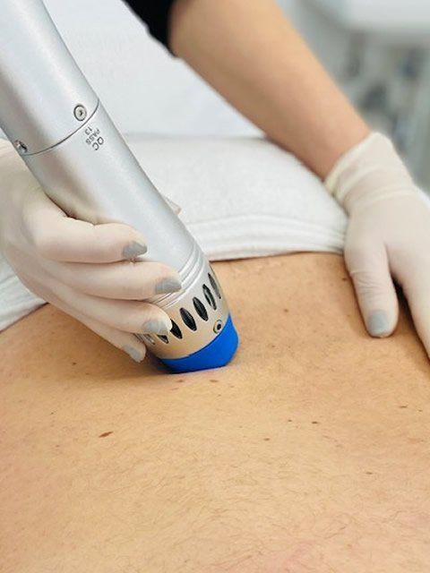 ondas de choque tratamiento lumbar 3